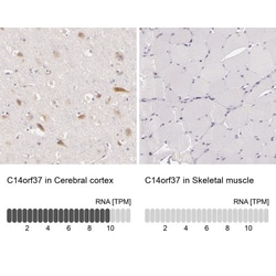 Chondroitin sulfate synthase 3 Antibody, Novus Biologicals:Antibodies:Primary